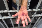 Foto mostra as marcas dessa agressão cruel e brutal pode ser vista nas mãos de Igor Eduardo que atacou a ex com 61 socos Foto mostra as marcas dessa agressão cruel e brutal pode ser vista nas mãos de Igor Eduardo que atacou a ex com 61 socos