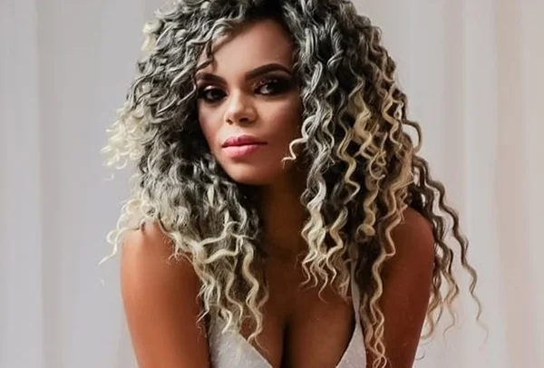Kelly Cristina denuncia que cirurgia plástica a deixou com queimaduras, em Goiânia, Goiás