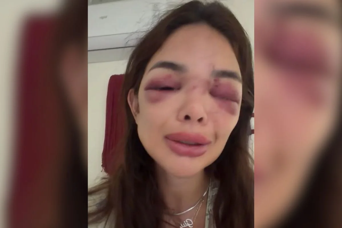 Giullia Kos acusa o marido, Ivo Kos, de agredí-la Giullia Kos acusa o marido, Ivo Kos, de agredí-la
