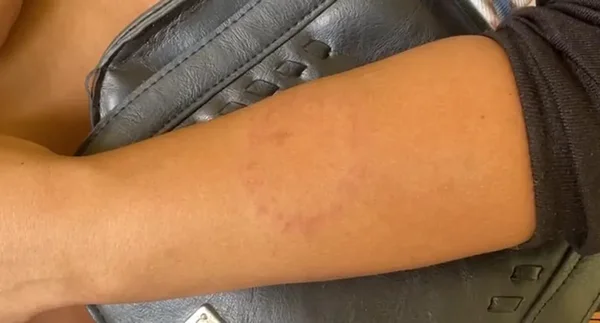 Mulher desmaia após ser agredida por ex-namorado