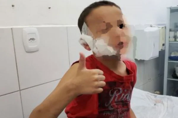 Família de menino atacada por Pitbull registra B.O. contra dono do cão