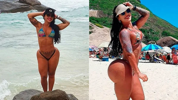 Bumbum na nuca: Vanessa Ataides quer ter a maior bunda do mundo