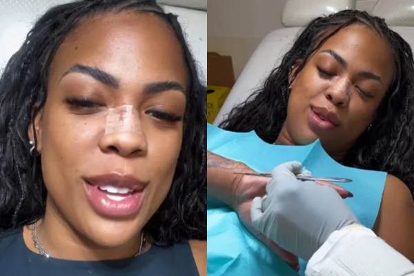 Cantora Marvvila mostra detalhes de cirurgia para remoção do 6ª dedo