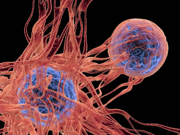 Foto colorida de célula cancerígena