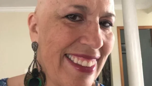 Mulher sem cabelos sorrindo para foto