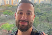 Diego Hypolito mostrou as alterações no rosto