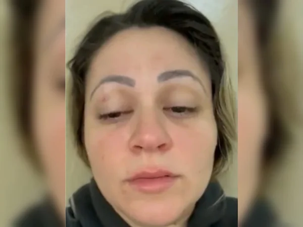 Imagem colorida de mulher olhando para baixo - Metrópoles