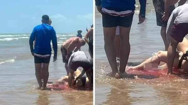 imagem colorida ataque tubarao praia eua - Metrópoles