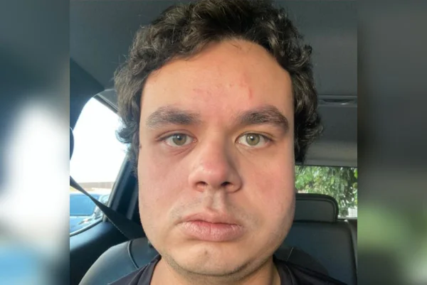 Imagem colorida de um homem com pele clara e olhos claros - Metrópoles