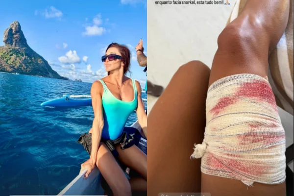 Imagem colorida, Advogada é mordida por tubarão ao fazer snorkel em Fernando de Noronha - Metrópoles