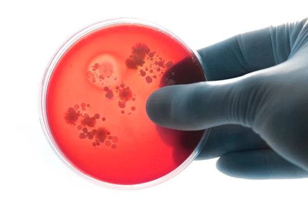 Imagem colorida de uma mão segurando uma forma redonda na cor laranja - Metrópoles - meningite