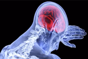 Quanto mais elevadas as taxas de LDL, maior o risco de doenças cardiovasculares, como infarto e acidente vascular cerebral (AVC) Quanto mais elevadas as taxas de LDL, maior o risco de doenças cardiovasculares, como infarto e acidente vascular cerebral (AVC)