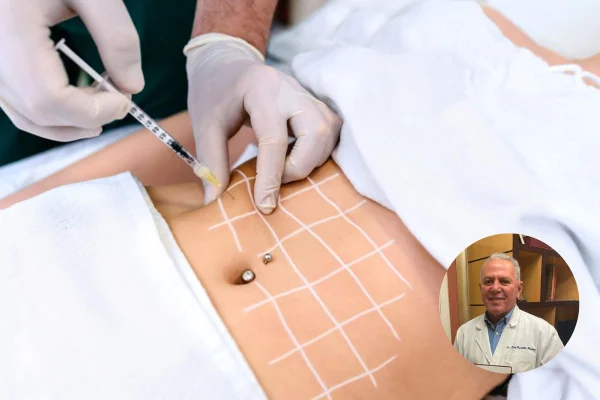 A imagem mostra a barriga de uma mulher riscada por caneta de marcação e uma mão está segurando uma seringa fazendo uma intervenção estética - Metrópoles