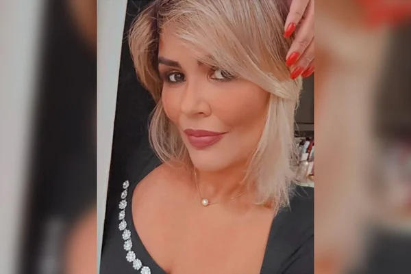 Imagem colorida de uma mulher com pele e cabelos claros - Metrópoles