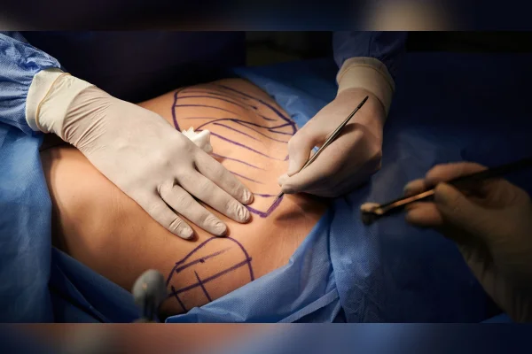cirurgia plástica