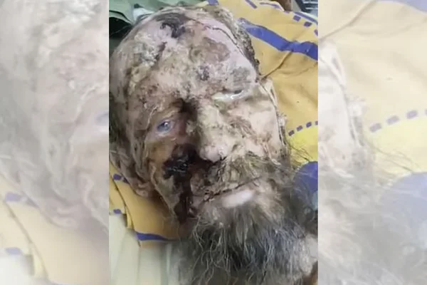 Morre homem que ficou conhecido por ter sido feito “refém de urso”