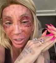 Maya Massafera contou que o objetivo é deixar a pele mais lisa