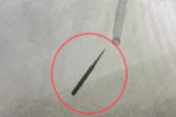 Homem engole broca no dentista e objeto vai parar no pulmão