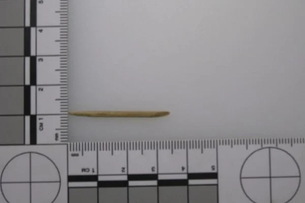 Mulher morre após palito de dente ficar preso na garganta