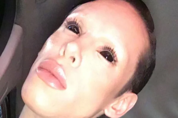 Homem faz cirurgia para tirar os genitais e ficar igual a um alien