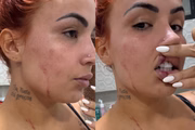 Influenciadora Ruivinha é baleada pelo ex-marido em perseguição em João Pessoa