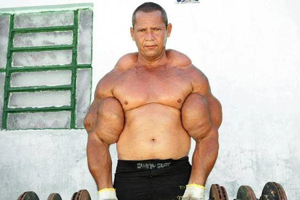 Quem era Arlindo Anomalia, o Popeye Brasileiro que morreu aos 55 anos