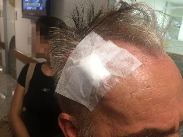 Em briga de trânsito, idoso é agredido por dois jovens na Asa Norte