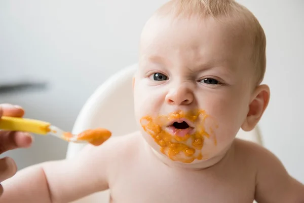 Saiba quais são os 7 alimentos que mais dão alergias em bebês