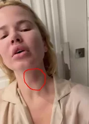 Marcela Tomaszewski ficou com o pescoço vermelho após ser agredida Marcela Tomaszewski ficou com o pescoço vermelho após ser agredida
