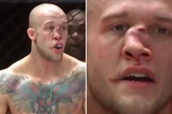 Blake Perry após fratura