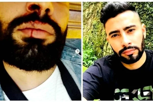 Produtor pornô sofre ataque homofóbico no Rio de Janeiro