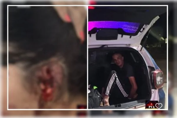Homem arranca pedaço da orelha da esposa