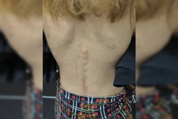 Trisal é denunciado por tortura após jovem de 16 anos fugir de cárcere