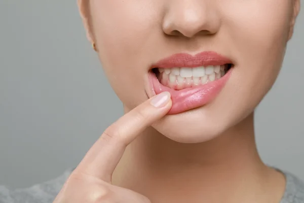 Mulher com dedo no dente - Metrópoles