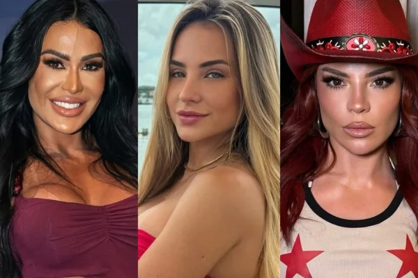 Rosto conhecido, traço irreconhecível: excessos estéticos das famosas - Metrópoles