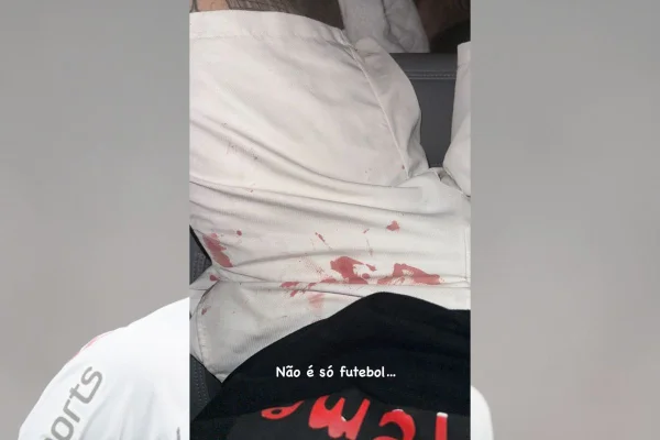 Luan publica foto com short ensanguentado após agressão de torcedores