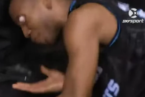 Olho de jogador de basquete pula para fora durante partida