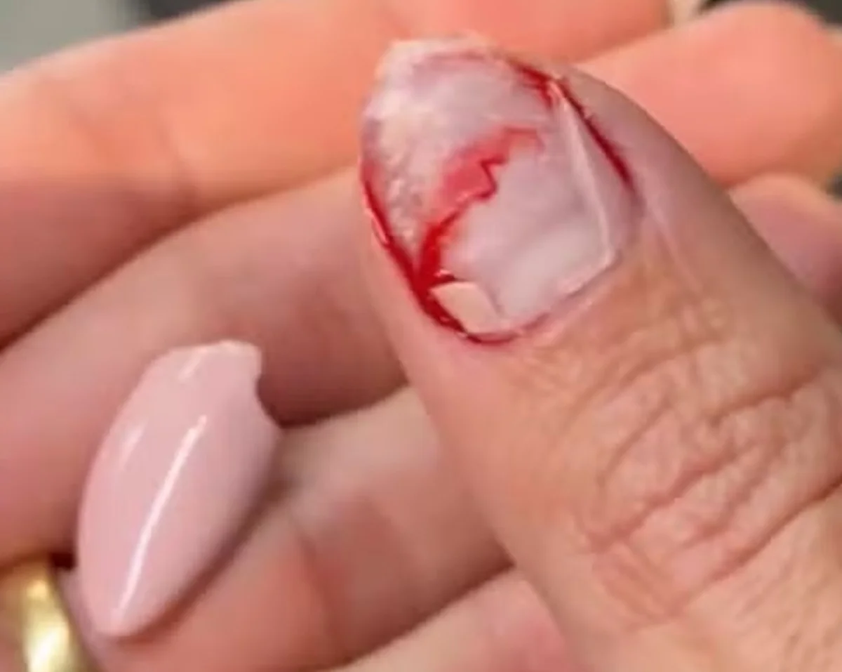 Aline Gotschalg surge com o dedo sangrando e desabafa: "Dia de sorte"
Aline Gotschalg surge com o dedo sangrando e desabafa: "Dia de sorte"