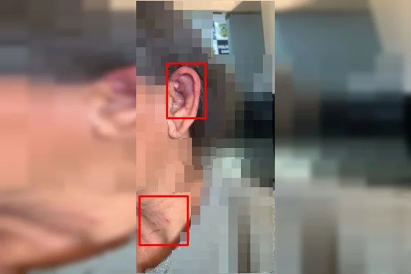 Mulher estrangulada com toalha foi atacada por amigo do filho