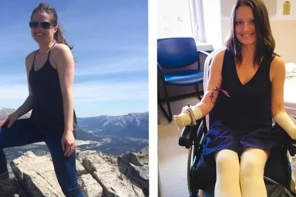 Colagem de fotos coloridas de mulher jovem. À esquerda ela sorri ao escalar uma montanha. À direita ela sorri em uma cadeira de rodas, sem os braços e sem as mãos.