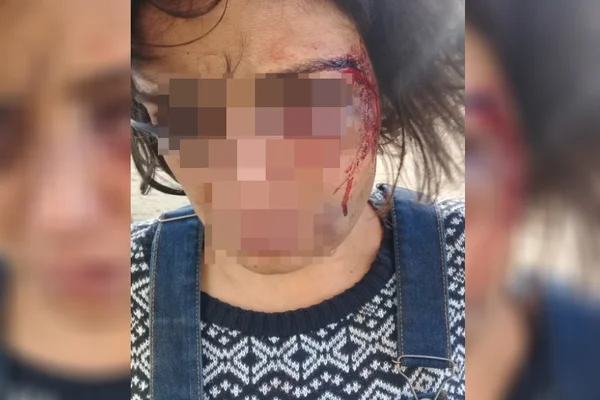 Homem espanca mulher, agride PMs e surta ao ser preso em Goiás
