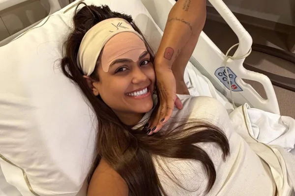 Camila Loures tira veia da testa; especialistas explicam procedimento