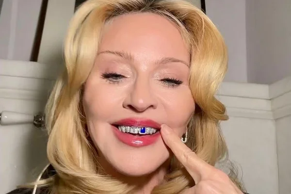Saiba o valor da joia dental usada por Madonna