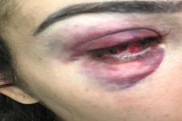Jovem espancada em boate no Lago: Pink Elephant cede imagens à PCDF