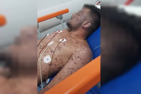 DF: Saúde investiga morte de jovem por meningite na UPA de Ceilândia