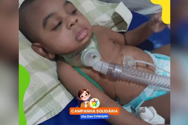 Instituto pede doações para bebê do DF com doença cerebral e epilepsia