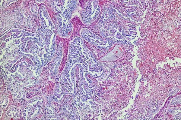 Imagem realizada por microscopia eletrônica de células do fígado humano. Ela é colorizada com tons rosa, roxos e azuis - Metrópoles