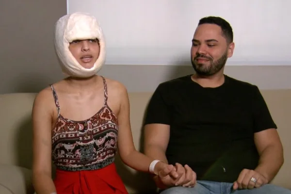 Jovem que perdeu couro cabeludo em kart: “Tem que seguir em frente”