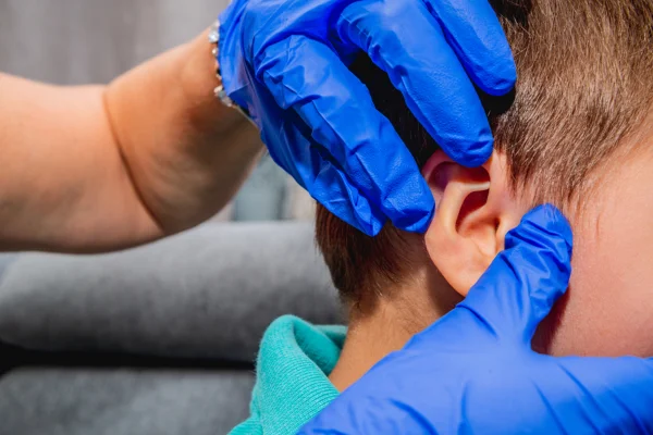 Otite externa: pediatra alerta para sintomas conforme idade da criança