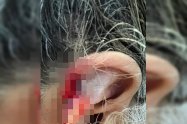 Neto arranca e engole pedaço da orelha da avó durante agressão